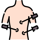 minimally-invasive-gynecological-surgeries treatmentby Dr.Anusha in hyderabad